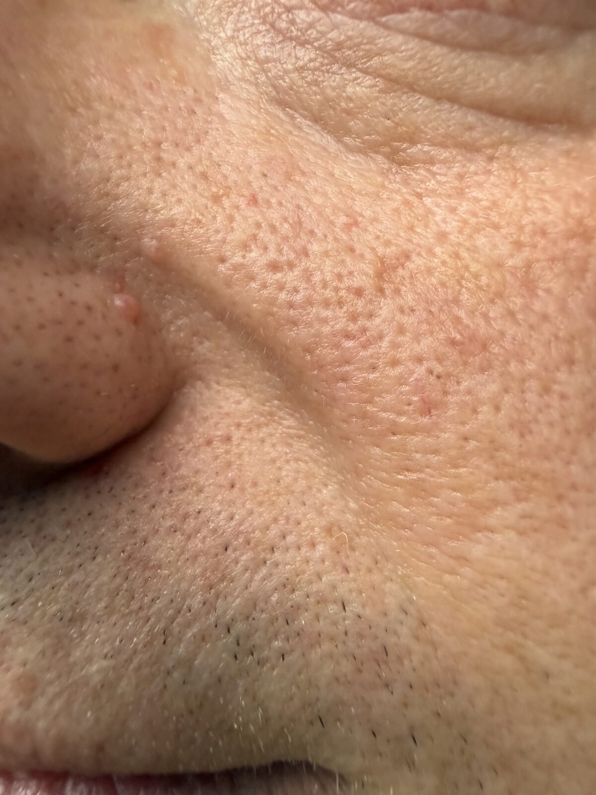 Close view of facial hair and skin texture