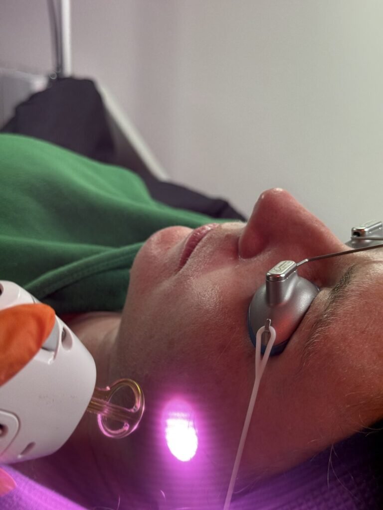 Vanessa Hill carrying out facial laser hair removal in her private Worcester clinic