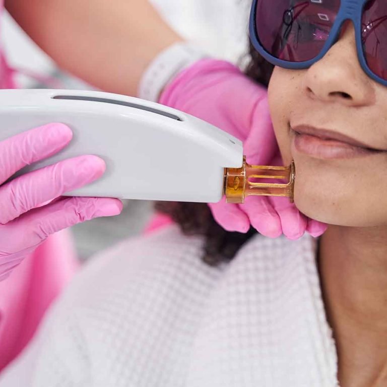 aesthetic-medicine-doctor-holding-a-laser-epilator-2024-10-21-14-52-31-utc