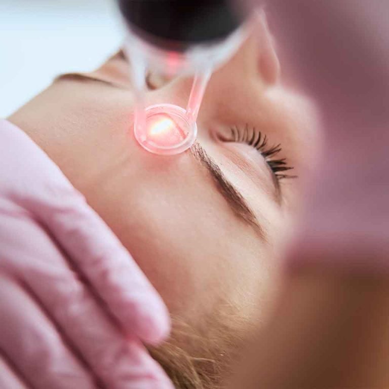laser-facials
