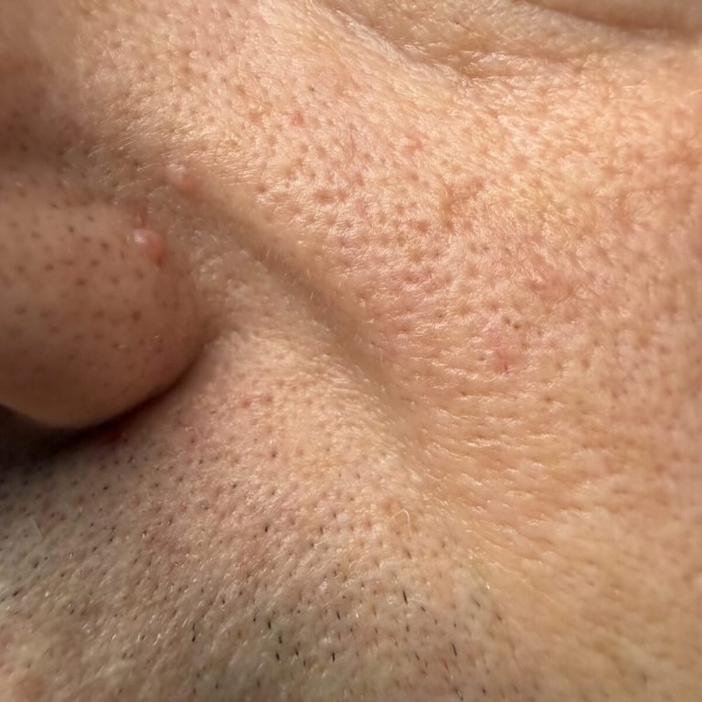 Close view of facial hair and skin texture